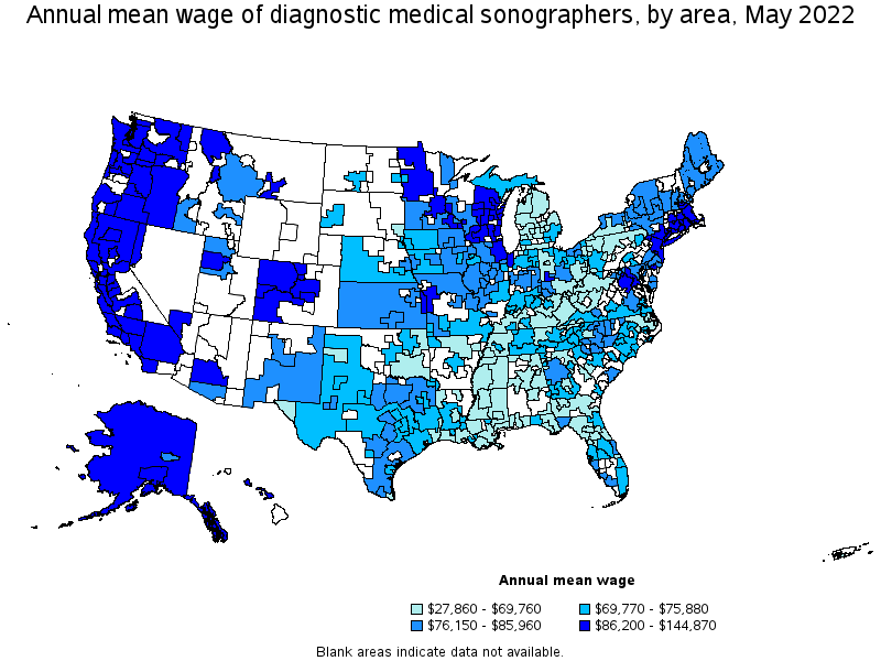 Map of annual mean wages of diagnostic medical sonographers by area, May 2022