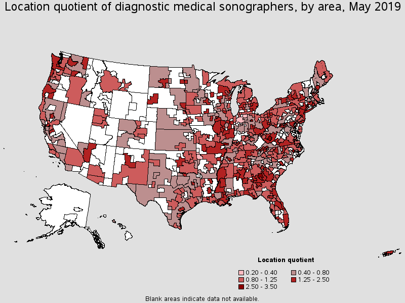 ultrasound tech salary illinois 2019