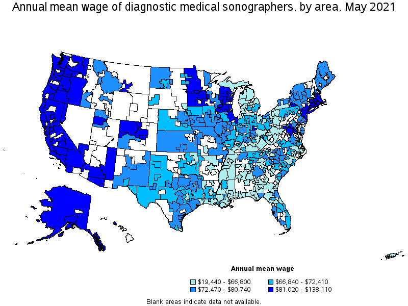 Map of annual mean wages of diagnostic medical sonographers by area, May 2021