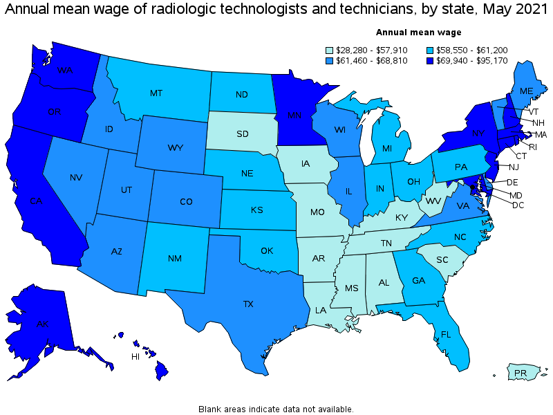 Map of annual mean wages of radiologic technologists and technicians by state, May 2021