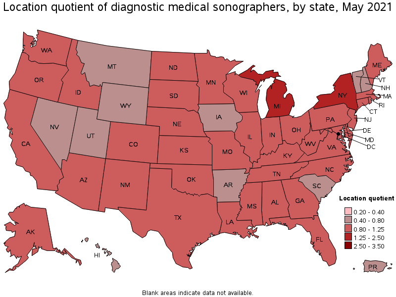 Map of location quotient of diagnostic medical sonographers by state, May 2021