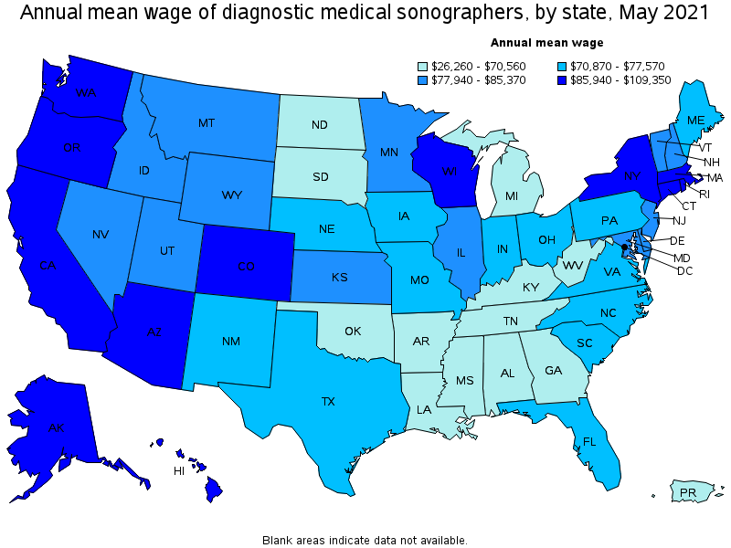 Map of annual mean wages of diagnostic medical sonographers by state, May 2021