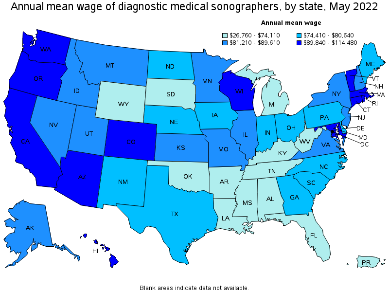 Map of annual mean wages of diagnostic medical sonographers by state, May 2022