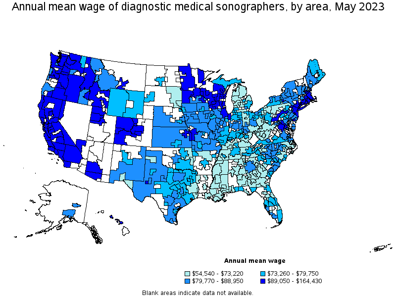 Map of annual mean wages of diagnostic medical sonographers by area, May 2023