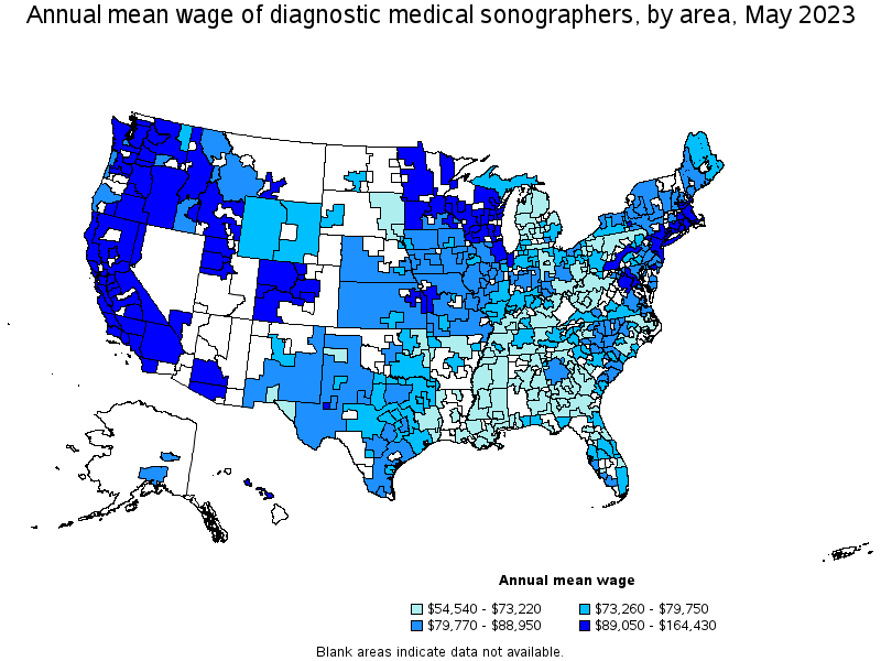 ultrasound technician salary illinois per hour