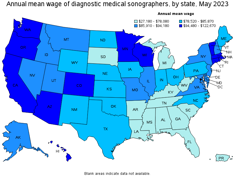Map of annual mean wages of diagnostic medical sonographers by state, May 2022