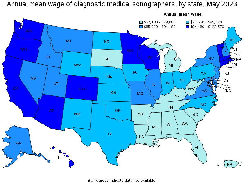 Map of annual mean wages of diagnostic medical sonographers by state, May 2023